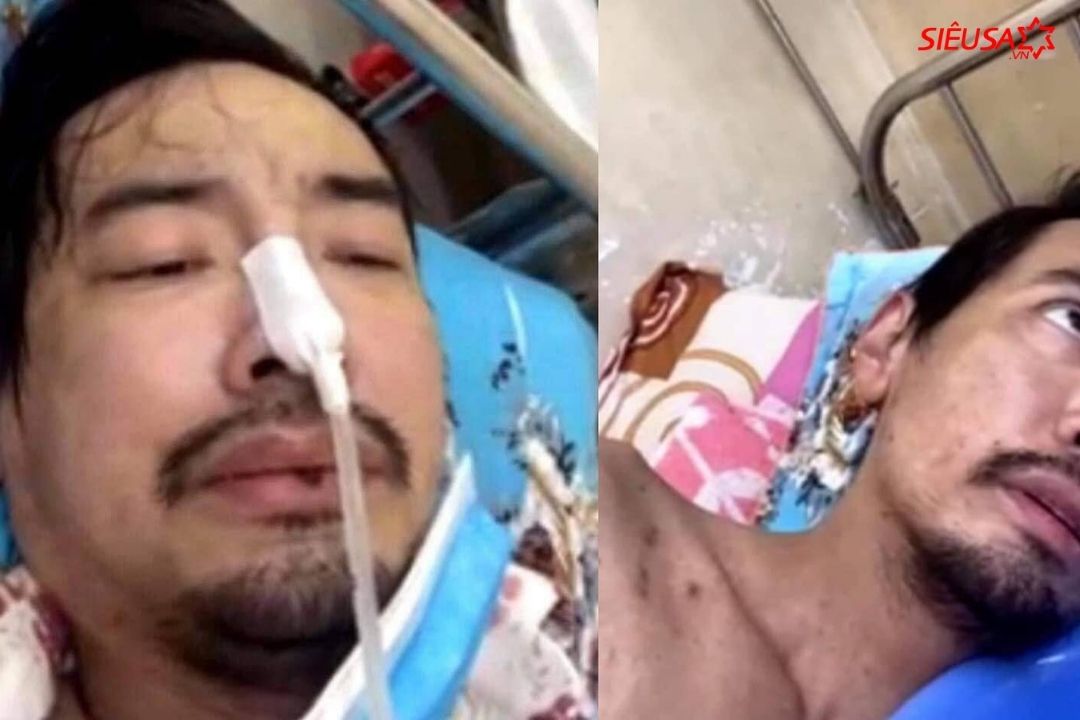 Đầu tháng 4, ca sĩ Việt Quang nhập viện trong tình hình viêm phổi nặng